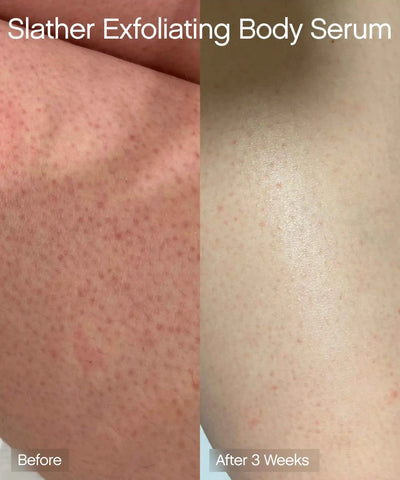Exfoliating Body Duo