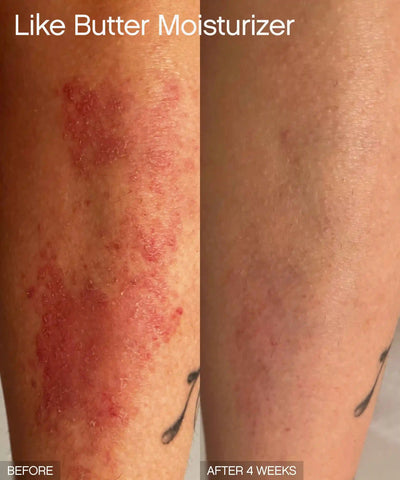 Discoloration Duo